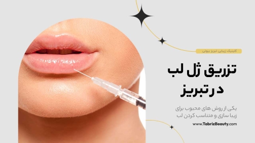 تزریق ژل لب در تبریز
