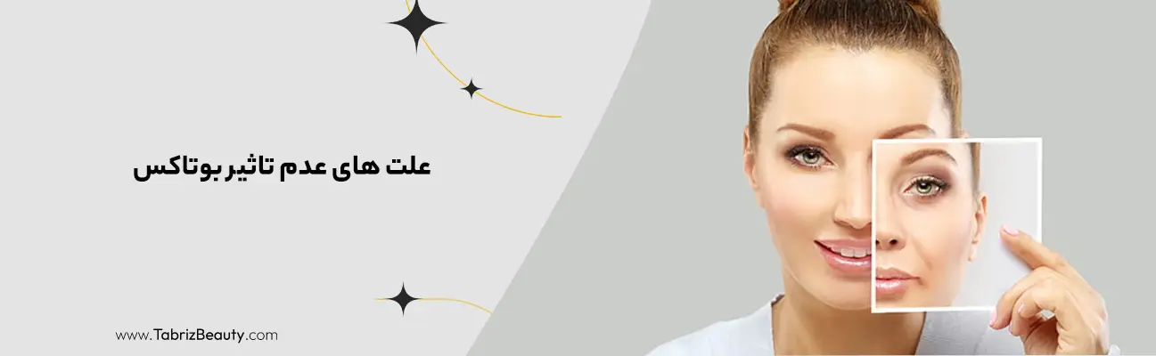 علت های عدم تاثیر بوتاکس