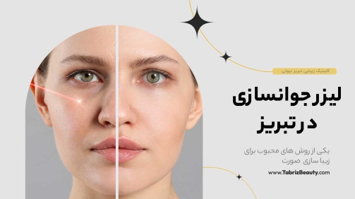 لیزر جوانسازی در تبریز