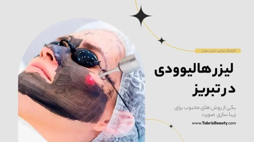 لیزر هالیوودی در تبریز