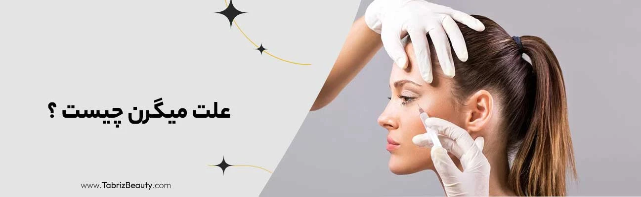 علت میگرن چیست ؟