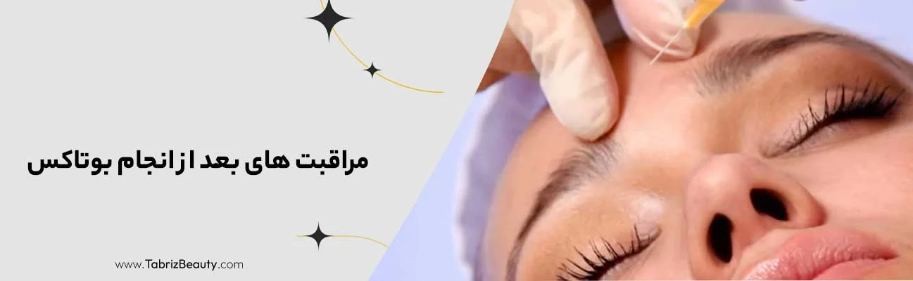 مراقبت‌ های بعد از انجام بوتاکس