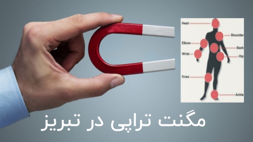 مگنت تراپی در تبریز