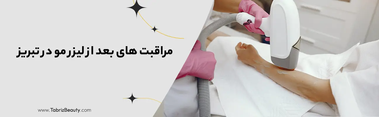 مراقبت های بعد از لیزر مو در تبریز