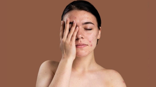 مشکلات پوستی ناشی از آلودگی هوا