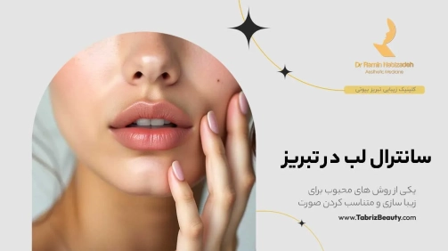 سانترال لبدر تبریز