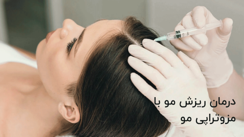 درمان ریزش مو با مزوتراپی مو