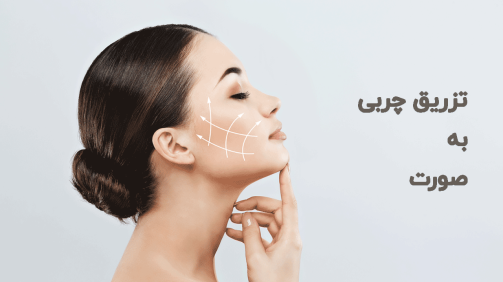 تزریق چربی به صورت