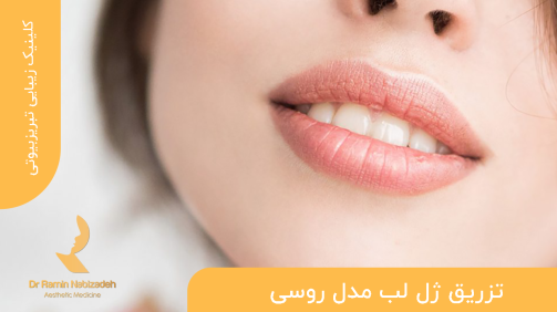تزریق ژل لب مدل روسی