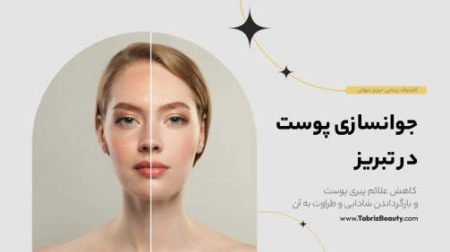 جوانسازی پوست در تبریز