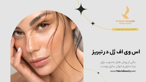 اس وی اف ژل در تبریز