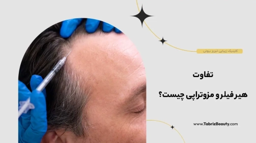 تفاوت هیر فیلر و مزوتراپی چیست