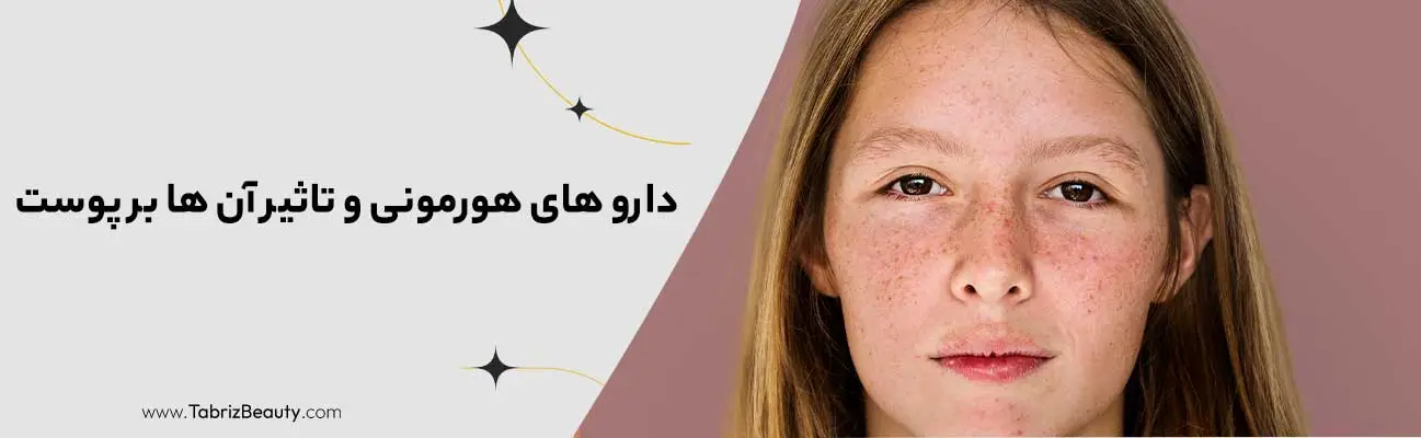 دارو های هورمونی و تاثیر آن ها بر پوست