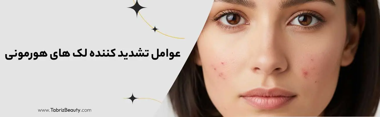 عوامل تشدید کننده لک های هورمونی کدامند؟
