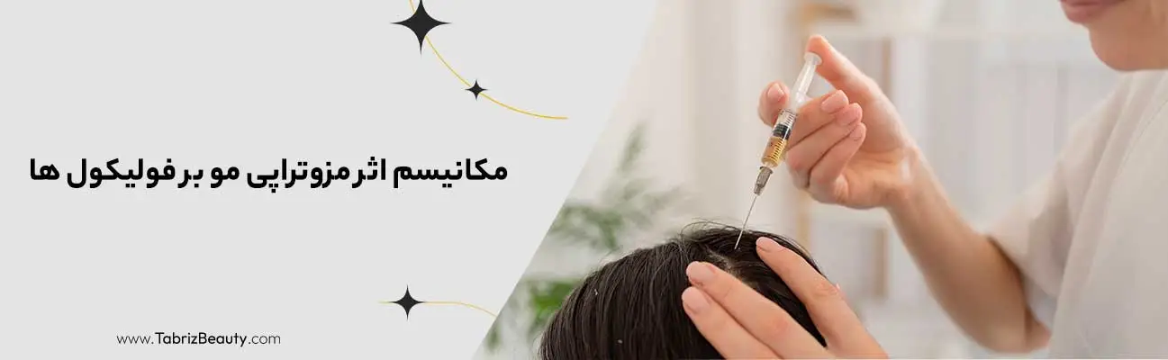 مکانیسم اثر مزوتراپی مو بر فولیکول ها چگونه است؟