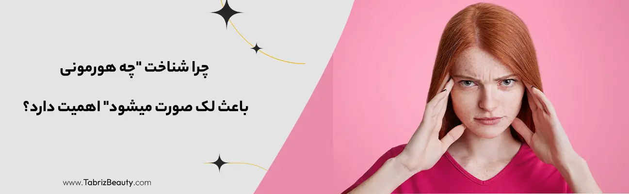 چرا شناخت "چه هورمونی باعث لک صورت میشود" اهمیت دارد؟