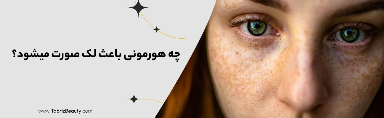 چه هورمونی باعث لک صورت میشود؟