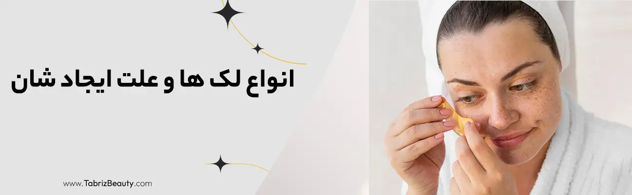 انواع لک ها و علت ایجاد شان