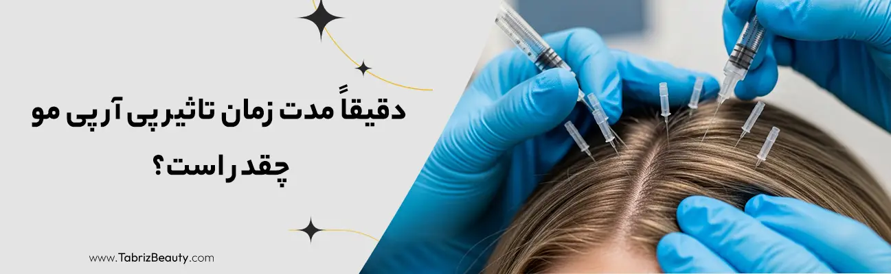 دقیقاً مدت زمان تاثیر پی آر پی مو PRP چقدر است؟