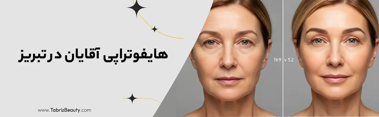 هایفوتراپی آقایان در تبریز